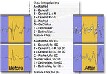 Sonic Studio Manual DeClick II